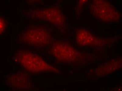 Immunofluorescence staining of methanol-fixed Hela cells using CDK6(phospho-Tyr24) Antibody.Rabbit anti-Human CDK6 Polyclonal Antibody