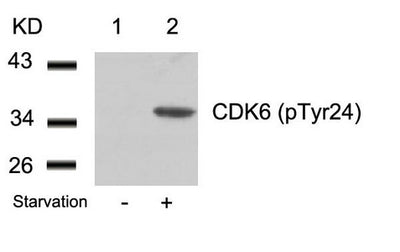 Western blot analysis of extracts from 293 cells untreated(lane 1) or treated with starvation(lane 2) using CDK6(phospho-Tyr24) Antibody.Rabbit anti-Human CDK6 Polyclonal Antibody