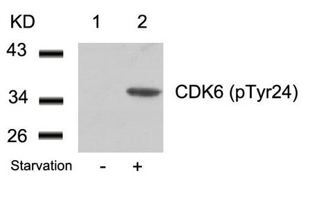 Western blot analysis of extracts from 293 cells untreated(lane 1) or treated with starvation(lane 2) using CDK6(phospho-Tyr24) Antibody.Rabbit anti-Human CDK6 Polyclonal Antibody