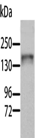 Gel: 10%SDS-PAGE, Lysate: 40 μg, Lane: Human liver tissue, Primary antibody: AOX1 Antibody(AOX1 Antibody) at dilution 1/1000, Secondary antibody: Goat anti rabbit IgG at 1/8000 dilution, Exposure time: 30 secondsRabbit anti-Human AOX1 Polyclonal Antibody