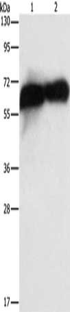 Gel: 15%SDS-PAGE, Lysate: 40 μg, Lane 1-2: HepG2 cells, human placenta tissue, Primary antibody: ALPP Antibody(ALPP Antibody) at dilution 1/1450, Secondary antibody: Goat anti rabbit IgG at 1/8000 dilution, Exposure time: 10 secondsRabbit anti-Human ALPP Polyclonal Antibody