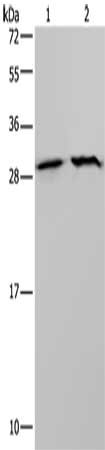 Gel: 10%SDS-PAGE, Lysate: 40 μg, Lane 1-2: LoVo cells, Hela cells, Primary antibody: ETFB Antibody(ETFB Antibody) at dilution 1/200, Secondary antibody: Goat anti rabbit IgG at 1/8000 dilution, Exposure time: 20 secondsRabbit anti-Human ETFB Polyclonal Antibody