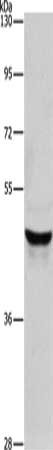 Gel: 8%SDS-PAGE, Lysate: 40 μg, Lane: Lovo cells, Primary antibody: KRT40 Antibody(KRT40 Antibody) at dilution 1/950, Secondary antibody: Goat anti rabbit IgG at 1/8000 dilution, Exposure time: 10 seconds