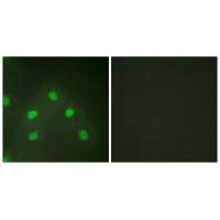 Immunofluorescence analysis of HeLa cells, using hnRNP L antibody.Rabbit anti-Human HNRNPL Polyclonal Antibody