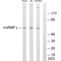 Western blot analysis of extracts from HeLa cells, Jurkat cells and HUVEC cells, using hnRNP L antibody.Rabbit anti-Human HNRNPL Polyclonal Antibody