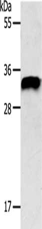 Gel: 12%SDS-PAGE, Lysate: 40 μg, Lane: Mouse brain tissue, Primary antibody: STX1A Antibody(STX1A Antibody) at dilution 1/350, Secondary antibody: Goat anti rabbit IgG at 1/8000 dilution, Exposure time: 20 secondsRabbit anti-Human STX1A Polyclonal Antibody