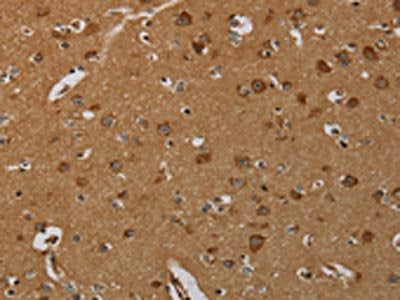 The image on the left is immunohistochemistry of paraffin-embedded Human brain  tissue using TAB1 Antibody(TAB1 Antibody) at dilution 1/50, on the right is treated with fusion protein. (Original magnification: ×200)Rabbit anti-Human TAB1 Polyclonal Antibody