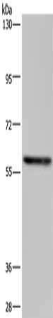 Gel: 6%SDS-PAGE, Lysate: 40 μg, Lane: 293T cells, Primary antibody: TAB1 Antibody(TAB1 Antibody) at dilution 1/350, Secondary antibody: Goat anti rabbit IgG at 1/8000 dilution, Exposure time: 20 secondsRabbit anti-Human TAB1 Polyclonal Antibody