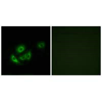 Immunofluorescence analysis of A549 cells, using MRPL11 antibody.Rabbit anti-Human MRPL11 Polyclonal Antibody
