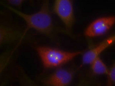 Immunofluorescence staining of methanol-fixed Hela cells using b-Catenin(Ab-33) Antibody.Rabbit anti-Human CTNNB1 Polyclonal Antibody