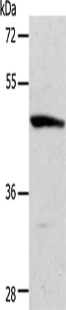 Gel: 10%SDS-PAGE, Lysate: 40 μg, Lane: Mouse brain tissue, Primary antibody: ACTR3B Antibody(ACTR3B Antibody) at dilution 1/250, Secondary antibody: Goat anti rabbit IgG at 1/8000 dilution, Exposure time: 30 seconds