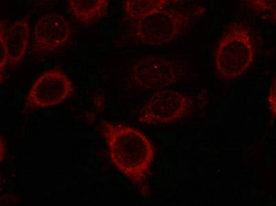 Immunofluorescence staining of methanol-fixed MCF cells using mTOR(Phospho-Ser2448) Antibody.Rabbit anti-Human MTOR Polyclonal Antibody