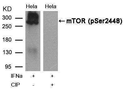 Western blot analysis of extracts from Hela cells, treatedwith IFNa or calf intestinal phosphatase (CIP), using mTOR(Phospho-Ser2448) Antibody.Rabbit anti-Human MTOR Polyclonal Antibody