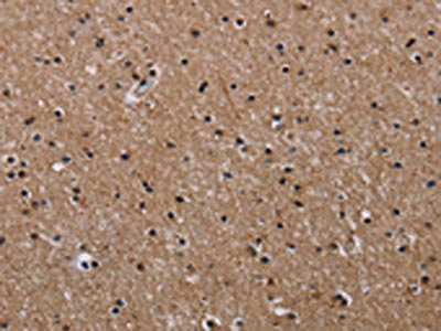 The image on the left is immunohistochemistry of paraffin-embedded Human brain  tissue using CLDND1 Antibody(CLDND1 Antibody) at dilution 1/50, on the right is treated with fusion protein. (Original magnification: ×200)Rabbit anti-Human CLDND1 Polyclonal Antibody