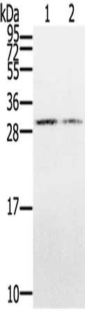 Gel: 12%SDS-PAGE, Lysate: 40 μg, Lane 1-2: Hepg2 cells, K562 cells, Primary antibody: CLDND1 Antibody(CLDND1 Antibody) at dilution 1/500, Secondary antibody: Goat anti rabbit IgG at 1/8000 dilution, Exposure time: 3 minutesRabbit anti-Human CLDND1 Polyclonal Antibody