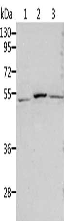 Gel: 10%SDS-PAGE, Lysate: 40 μg, Lane 1-3: Human normal kidney tissue, Human liver tissue, human liver cancer tissue, Primary antibody: ALDH3B1 Antibody(ALDH3B1 Antibody) at dilution 1/200, Secondary antibody: Goat anti rabbit IgG at 1/8000 dilution, Exposure time: 45 secondsRabbit anti-Human ALDH3B1 Polyclonal Antibody