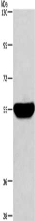 Gel: 6%SDS-PAGE, Lysate: 40 μg, Lane: Human fetal liver tissue, Primary antibody: HMGCS1 Antibody(HMGCS1 Antibody) at dilution 1/300, Secondary antibody: Goat anti rabbit IgG at 1/8000 dilution, Exposure time: 30 secondsRabbit anti-Human HMGCS1 Polyclonal Antibody