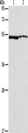 Gel: 10%SDS-PAGE, Lysate: 40 μg, Lane 1-2: A549 cells, mouse eye tissue, Primary antibody: ALDH3A1 Antibody(ALDH3A1 Antibody) at dilution 1/750, Secondary antibody: Goat anti rabbit IgG at 1/8000 dilution, Exposure time: 10 secondsRabbit anti-Human ALDH3A1 Polyclonal Antibody