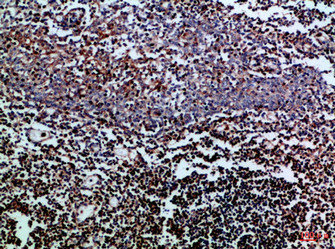 Immunohistochemical analysis of paraffin-embedded Human-tonsil, antibody was diluted at 1:100Rabbit anti-Human CD247 Polyclonal Antibody