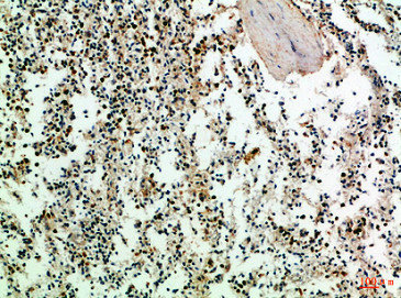 Immunohistochemical analysis of paraffin-embedded Human-spleen, antibody was diluted at 1:100Rabbit anti-Human CD247 Polyclonal Antibody
