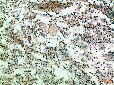 Immunohistochemical analysis of paraffin-embedded Human-spleen, antibody was diluted at 1:100Rabbit anti-Human CD247 Polyclonal Antibody