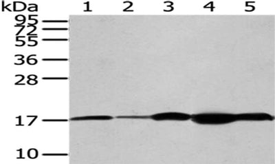 Gel: 12%SDS-PAGE,Lysate: 40 μg,Lane 1-5: A172 cells, Jurkat cells, Hela cells, Mouse brain tissue, Human fetal brain tissue,Primary antibody: VAMP2 Antibody(VAMP2 Antibody) at dilution 1/200 dilution,Secondary antibody: Goat anti rabbit IgG at 1/8000 dilution,Exposure time: 30 secondsRabbit anti-Human VAMP2 Polyclonal Antibody
