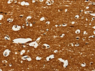 The image on the left is immunohistochemistry of paraffin-embedded Human brain  tissue using GOT1 Antibody(GOT1 Antibody) at dilution 1/50, on the right is treated with fusion protein. (Original magnification: ×200)Rabbit anti-Human GOT1 Polyclonal Antibody