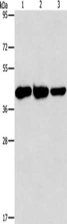 Gel: 15%SDS-PAGE, Lysate: 40 μg, Lane 1-3: Human normal liver tissue, mouse brain tissue, Mouse heart tissue, Primary antibody: GOT1 Antibody(GOT1 Antibody) at dilution 1/1600, Secondary antibody: Goat anti rabbit IgG at 1/8000 dilution, Exposure time: 5 secondsRabbit anti-Human GOT1 Polyclonal Antibody