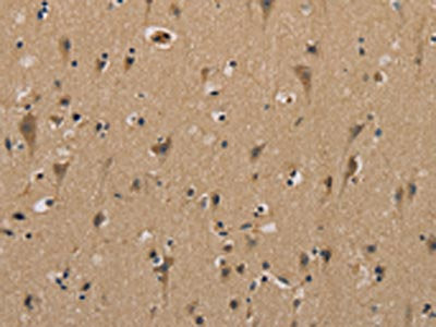 The image on the left is immunohistochemistry of paraffin-embedded Human brain  tissue using MYL3 Antibody(MYL3 Antibody) at dilution 1/40, on the right is treated with fusion protein. (Original magnification: ×200)Rabbit anti-Human MYL3 Polyclonal Antibody