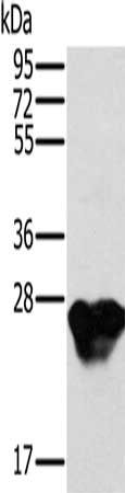 Gel: 10%SDS-PAGE, Lysate: 40 μg, Lane: Mouse heart tissue, Primary antibody: MYL3 Antibody(MYL3 Antibody) at dilution 1/500, Secondary antibody: Goat anti rabbit IgG at 1/8000 dilution, Exposure time: 10 secondsRabbit anti-Human MYL3 Polyclonal Antibody