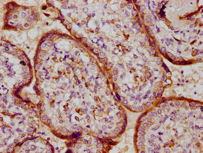 IHC image of PSG9 Antibody diluted at 1:100 and staining in paraffin-embedded human placenta tissue performed on a Leica BondTM system. After dewaxing and hydration, antigen retrieval was mediated by high pressure in a citrate buffer (pH 6.0). Section was blocked with 10% normal goat serum 30min at RT. Then primary antibody (1% BSA) was incubated at 4°C overnight. The primary is detected by a biotinylated secondary antibody and visualized using an HRP conjugated SP system.Rabbit anti-Human PSG9 Polyclonal Antibody