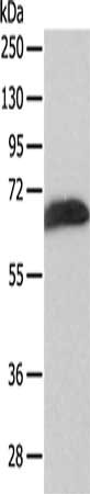 Gel: 12%SDS-PAGE, Lysate: 50 μg, Lane: Human liver cancer tissue, Primary antibody: SPATA16 Antibody(SPATA16 Antibody) at dilution 1/200, Secondary antibody: Goat anti rabbit IgG at 1/8000 dilution, Exposure time: 40 secondsRabbit anti-Human SPATA16 Polyclonal Antibody