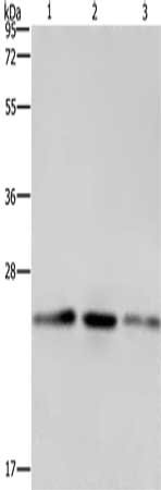 Gel: 10%SDS-PAGE, Lysate: 40 μg, Lane 1-3: A549 cells, Hela cells, HT29 cells, Primary antibody: EMC8 Antibody(EMC8 Antibody) at dilution 1/600, Secondary antibody: Goat anti rabbit IgG at 1/8000 dilution, Exposure time: 1 minuteRabbit anti-Human EMC8 Polyclonal Antibody
