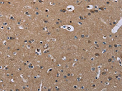 The image on the left is immunohistochemistry of paraffin-embedded Human brain  tissue using CSNK1A1 Antibody(CSNK1A1 Antibody) at dilution 1/20, on the right is treated with synthetic peptide. (Original magnification: ×200)Rabbit anti-Human CSNK1A1 Polyclonal Antibody