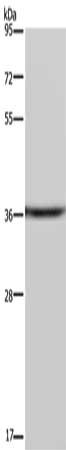 Gel: 8%SDS-PAGE, Lysate: 40 μg, Lane: A549 cells, Primary antibody: CSNK1A1 Antibody(CSNK1A1 Antibody) at dilution 1/200, Secondary antibody: Goat anti rabbit IgG at 1/8000 dilution, Exposure time: 10 minutesRabbit anti-Human CSNK1A1 Polyclonal Antibody