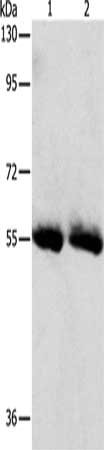 Gel: 8%SDS-PAGE, Lysate: 40 μg, Lane 1-2: Human colon tissue, Human ovarian cancer tissue, Primary antibody: SLC5A5 Antibody(SLC5A5 Antibody) at dilution 1/450, Secondary antibody: Goat anti rabbit IgG at 1/8000 dilution, Exposure time: 1 minuteRabbit anti-Human SLC5A5 Polyclonal Antibody