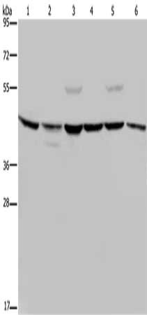Gel: 10%SDS-PAGE, Lysate: 40 μg, Lane 1-3: Mouse brain tissue, Hela cells, Jurkat cells, Primary antibody: CSNK2A1 Antibody(CSNK2A1 Antibody) at dilution 1/250, Secondary antibody: Goat anti rabbit IgG at 1/8000 dilution, Exposure time: 5 secondsRabbit anti-Human CSNK2A1 Polyclonal Antibody