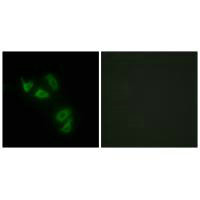 Immunofluorescence analysis of HepG2 cells, using MUC13 antibody.Rabbit anti-Human MUC13 Polyclonal Antibody