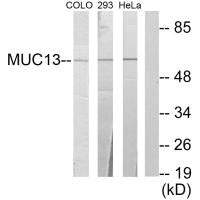 Western blot analysis of extracts from COLO cells, 293 cells and HeLa cells, using MUC13 antibody.Rabbit anti-Human MUC13 Polyclonal Antibody