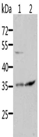Gel: 10%SDS-PAGE, Lysate: 40 μg, Lane 1-2: HT29 cells, 231 cells, Primary antibody: SOCS1 Antibody(SOCS1 Antibody) at dilution 1/1700, Secondary antibody: Goat anti rabbit IgG at 1/8000 dilution, Exposure time: 1 minuteRabbit anti-Human SOCS1 Polyclonal Antibody