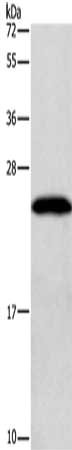 Gel: 10%SDS-PAGE, Lysate: 40 μg, Lane: K562 cells, Primary antibody: GAGE12I Antibody(GAGE12I Antibody) at dilution 1/200, Secondary antibody: Goat anti rabbit IgG at 1/8000 dilution, Exposure time: 20 secondsRabbit anti-Human GAGE12I Polyclonal Antibody