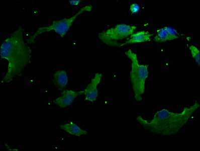Immunofluorescence staining of U251 cells with RHBDD3 Antibody at 1:50, counter-stained with DAPI. The cells were fixed in 4% formaldehyde, permeabilized using 0.2% Triton X-100 and blocked in 10% normal Goat Serum. The cells were then incubated with the antibody overnight at 4°C. The secondary antibody was Alexa Fluor 488-congugated AffiniPure Goat Anti-Rabbit IgG(H+L).Rabbit anti-Human RHBDD3 Polyclonal Antibody