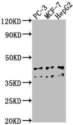 Western Blot | Positive WB detected in: PC-3 whole cell lysate, MCF-7 whole cell lysate, HepG2 whole cell lysate | All lanes: RHBDD3 antibody at 1:1000 | Secondary | Goat polyclonal to rabbit IgG at 1/50000 dilution | Predicted band size: 41 kDa | Observed band size: 41 kDaRabbit anti-Human RHBDD3 Polyclonal Antibody