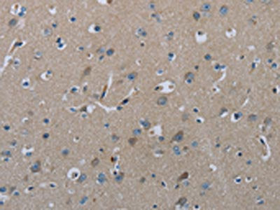 The image on the left is immunohistochemistry of paraffin-embedded Human brain  tissue using FAAH Antibody(FAAH Antibody) at dilution 1/50, on the right is treated with fusion protein. (Original magnification: ×200)Rabbit anti-Human FAAH Polyclonal Antibody