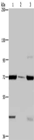 Gel: 6%SDS-PAGE, Lysate: 40 μg, Lane 1-3: LoVo cells, human testis tissue, A549 cells, Primary antibody: FAAH Antibody(FAAH Antibody) at dilution 1/400, Secondary antibody: Goat anti rabbit IgG at 1/8000 dilution, Exposure time: 2 minutesRabbit anti-Human FAAH Polyclonal Antibody