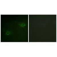 Immunofluorescence analysis of HeLa cells, using Syndecan4 (Ab-179) antibody.Rabbit anti-Human SDC4 Polyclonal Antibody