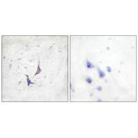 Immunohistochemistry analysis of paraffin-embedded human brain tissue using Syndecan4 (Ab-179) antibody.Rabbit anti-Human SDC4 Polyclonal Antibody