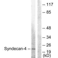 Western blot analysis of extracts from HepG2 cells, using Syndecan4 (Ab-179) antibody.Rabbit anti-Human SDC4 Polyclonal Antibody