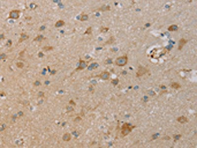 The image on the left is immunohistochemistry of paraffin-embedded Human brain tissue using the antibody Antibody) at dilution 1/20, on the right is treated with fusion protein. (Original magnification: ×200)Rabbit anti-Human PAGE2 Polyclonal Antibody