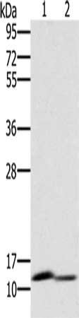 Gel: 10%SDS-PAGE, Lysate: 40 μg, Lane 1-2: Mouse brain tissue, Mouse kidney tissue, Primary antibody: PAGE2 Antibody(PAGE2 Antibody) at dilution 1/400, Secondary antibody: Goat anti rabbit IgG at 1/8000 dilution, Exposure time: 1 minuteRabbit anti-Human PAGE2 Polyclonal Antibody